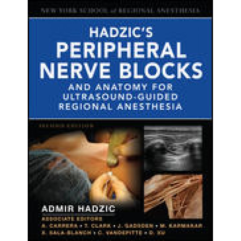 Hadzic's Peripheral Nerve Blocks